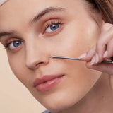 Двострано стапче за отстранување митесери