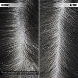 DUOLOGI Шампон против првут