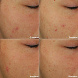 Blemish + Age Defy лесна рутина